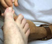 we can help with ingrown toenails perth