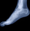 experts at fitting orthotics in perth